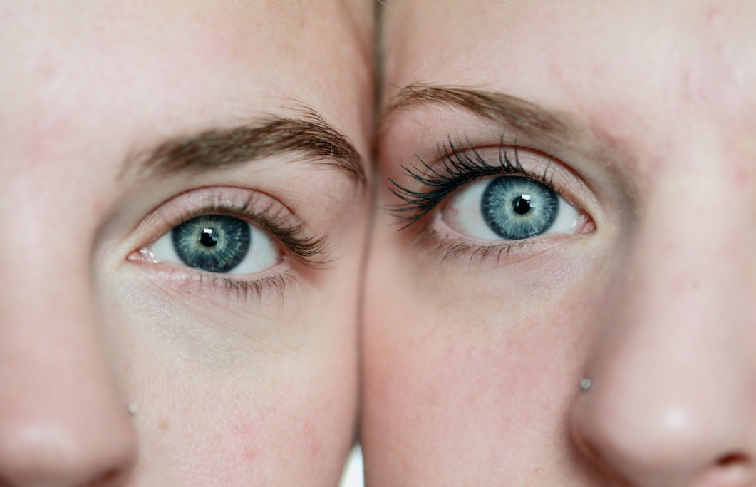 Top 5 Winter Skincare Tips