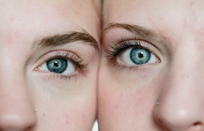 Top 5 Winter Skincare Tips